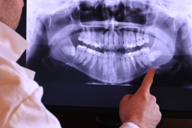 Best Emergency Tooth Extraction in Sayre, OK